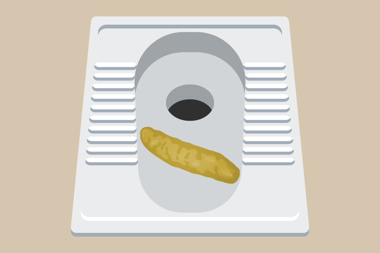 早期肝硬化大便图片 肝硬化患者大便图片