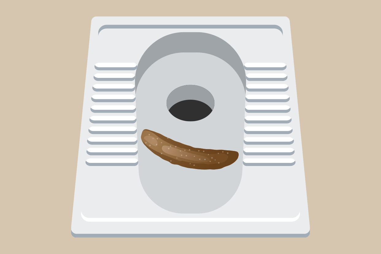 大便有白点图片（大便上有个白点）