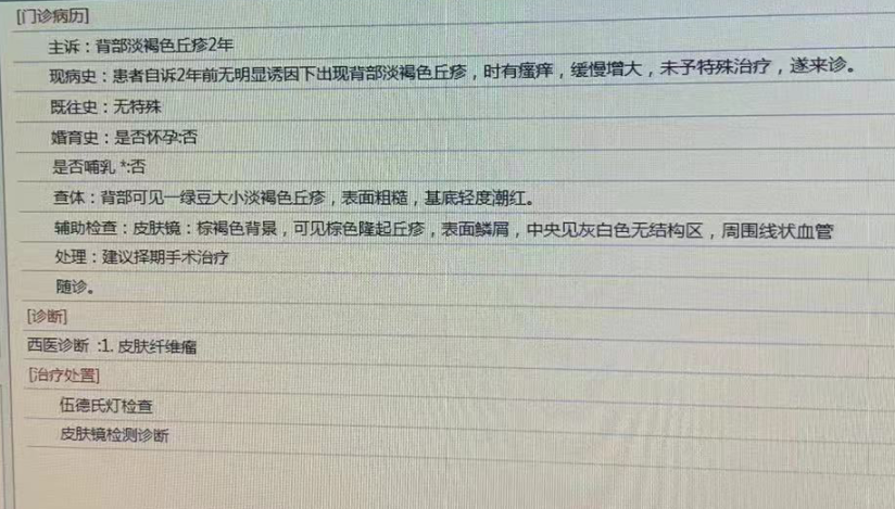 67岁女性后背发现褐色纤维瘤,手术切除后恢复较好