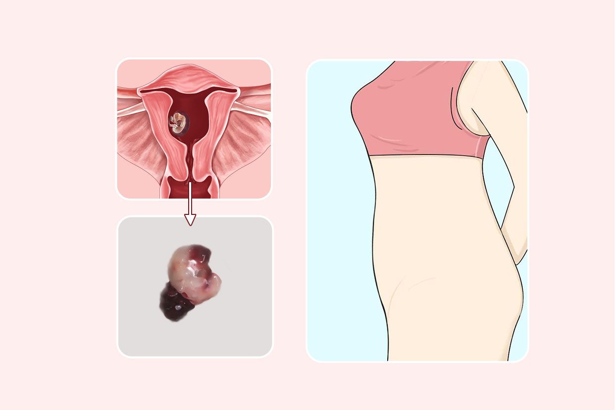 30天孕囊掉下来的图片（怀孕40天掉下来的孕囊图片）