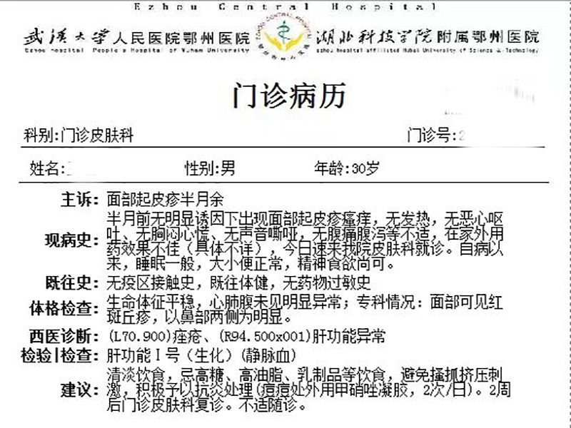 熬夜喝酒会引起痤疮,外用甲硝唑凝胶有效果