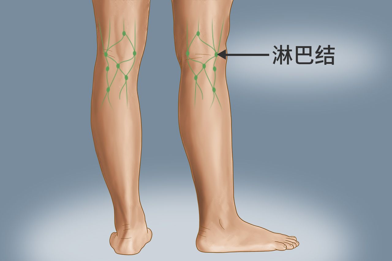 腿部腘窝淋巴结位置图片（腘窝淋巴结的位置图片）