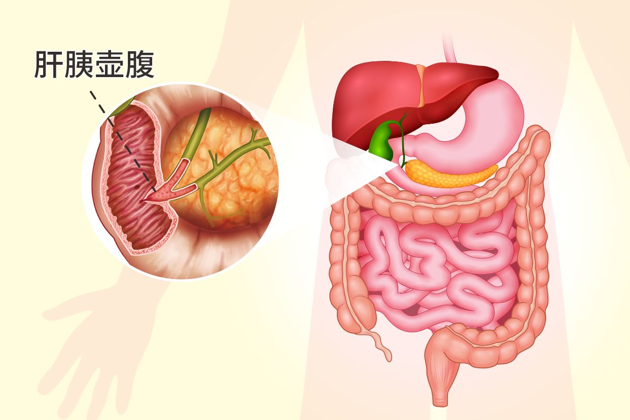 肝胰壶腹部在哪个位置图片（胆胰壶腹部在哪个位置图片）