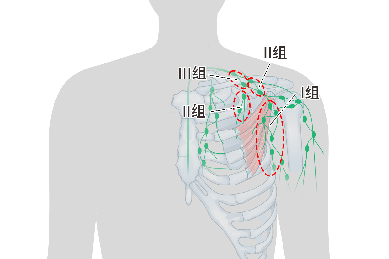 中央区淋巴结图片 中央组淋巴结什么位置