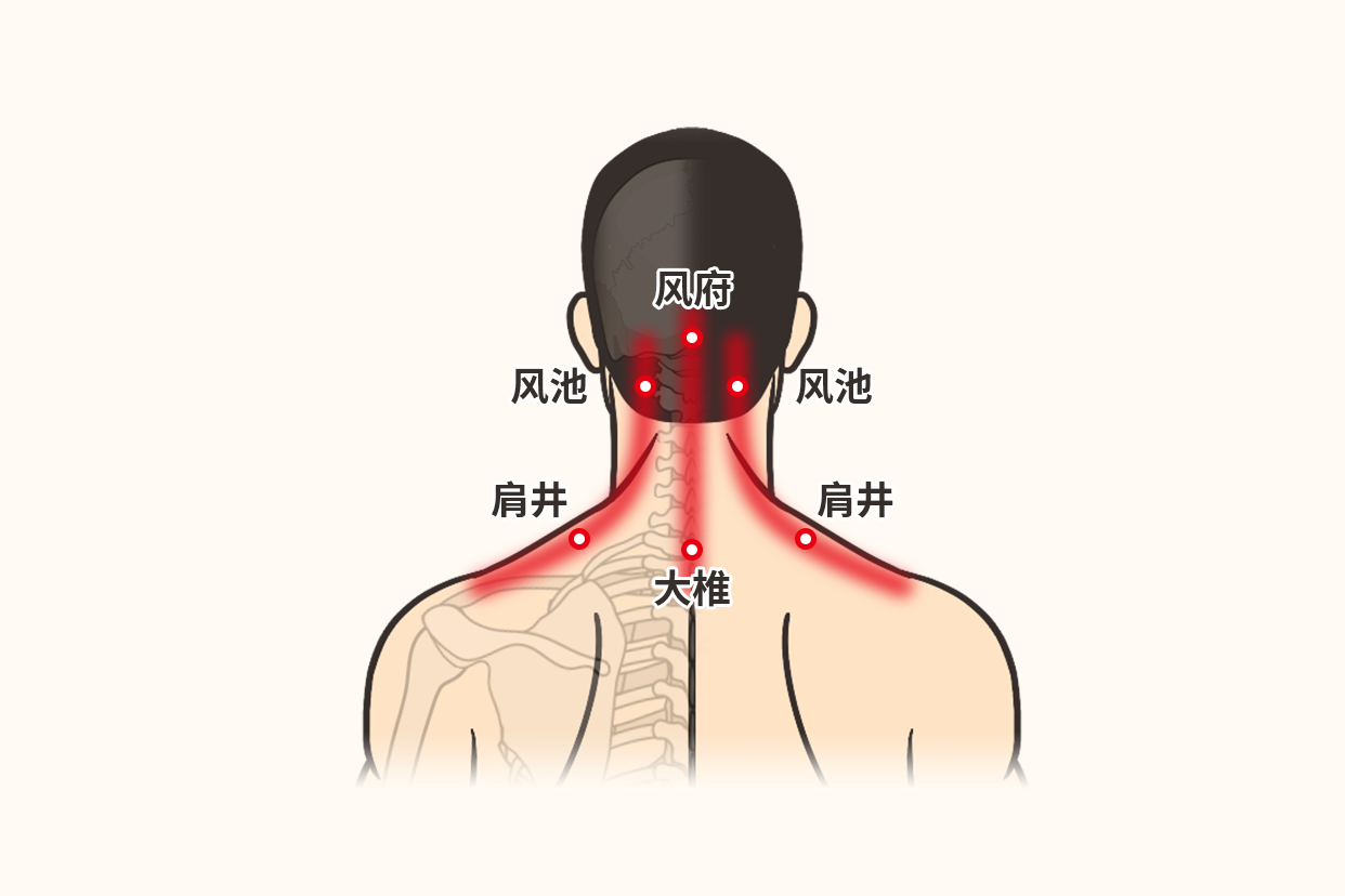 感冒头痛刮痧刮什么部位图（感冒刮痧位置图）