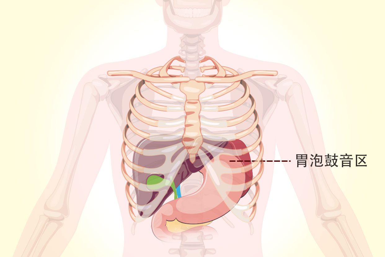 胃泡鼓音区示意图（急性胃扩张胃泡鼓音区）