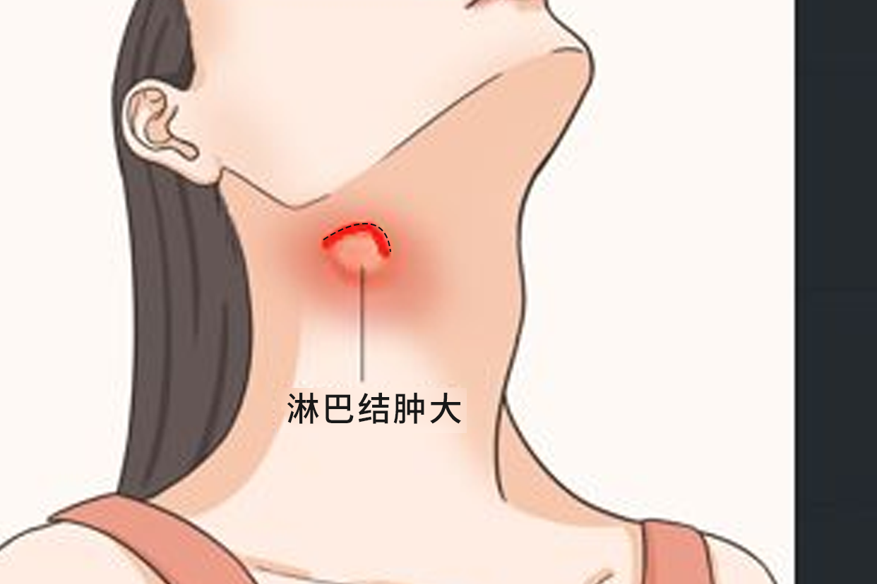 颈部淋巴手术切口图片