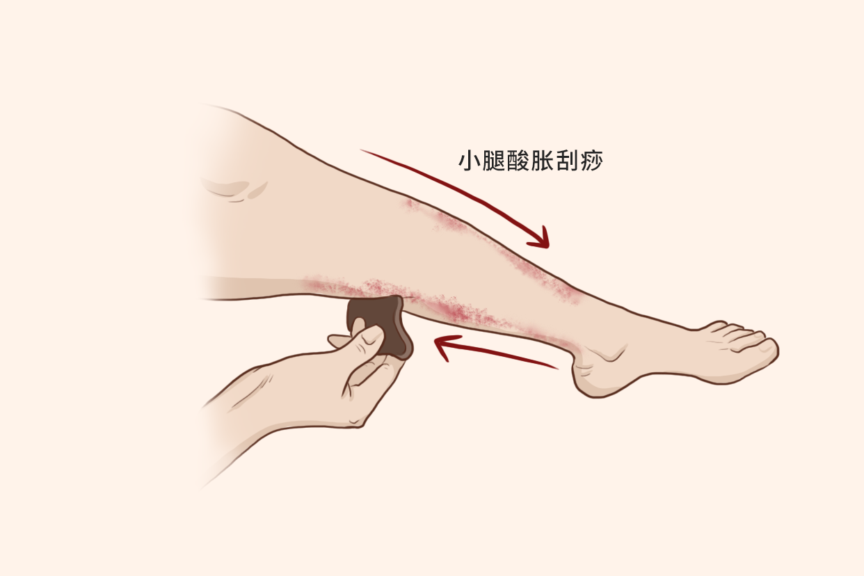 小腿酸胀刮痧的方法示意图