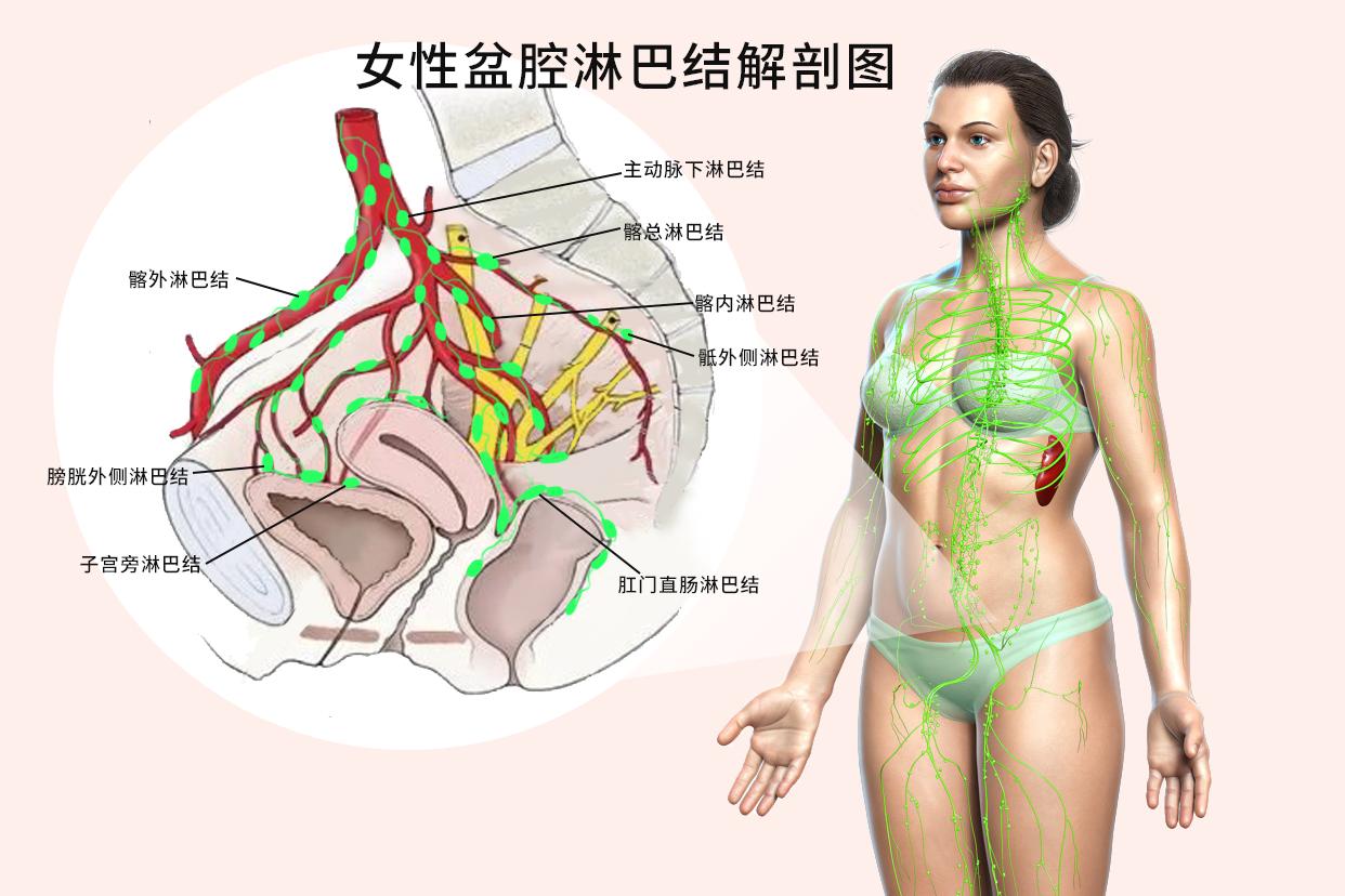 女性盆腔淋巴结解剖图 女性盆腔淋巴结解剖图片