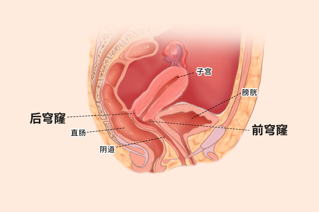 穹隆部位在哪里图片 穹隆部位是什么意思