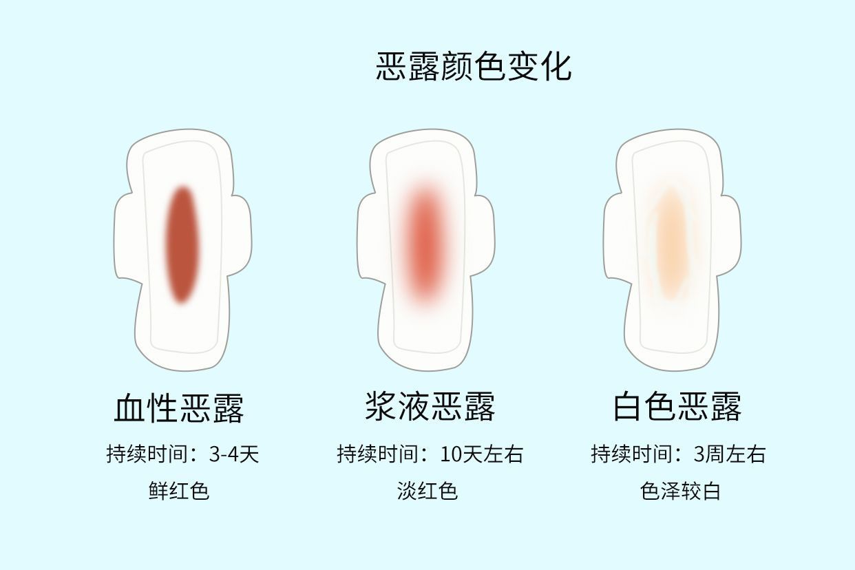 产后分泌物图片（产后分泌物是什么样的）