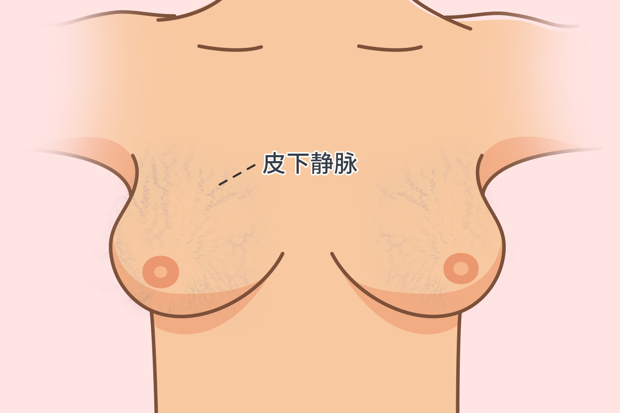 乳房皮下静脉图片（乳房皮下静脉图片解剖）