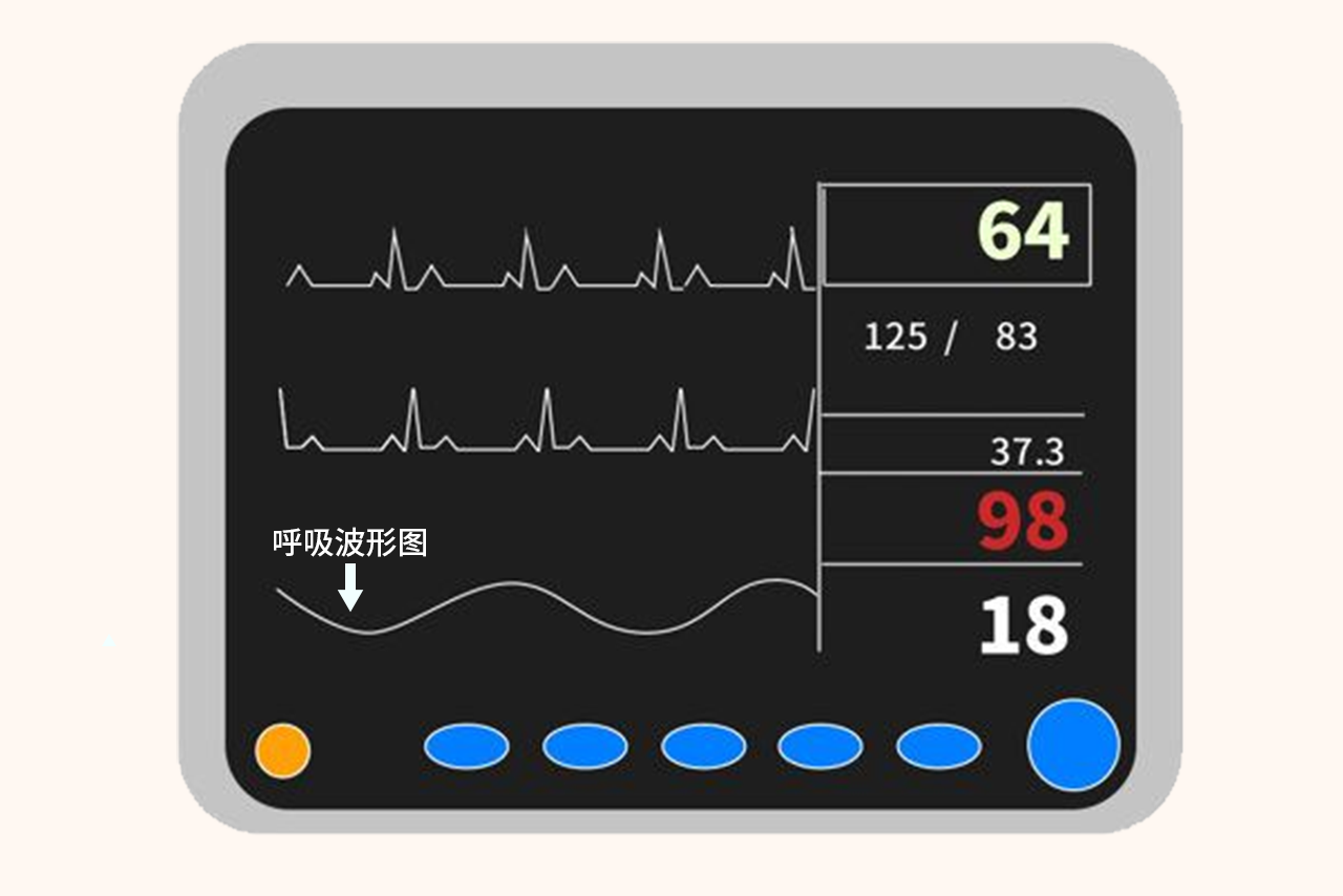 监护仪呼吸波形图 监护仪呼吸波形图呈直线