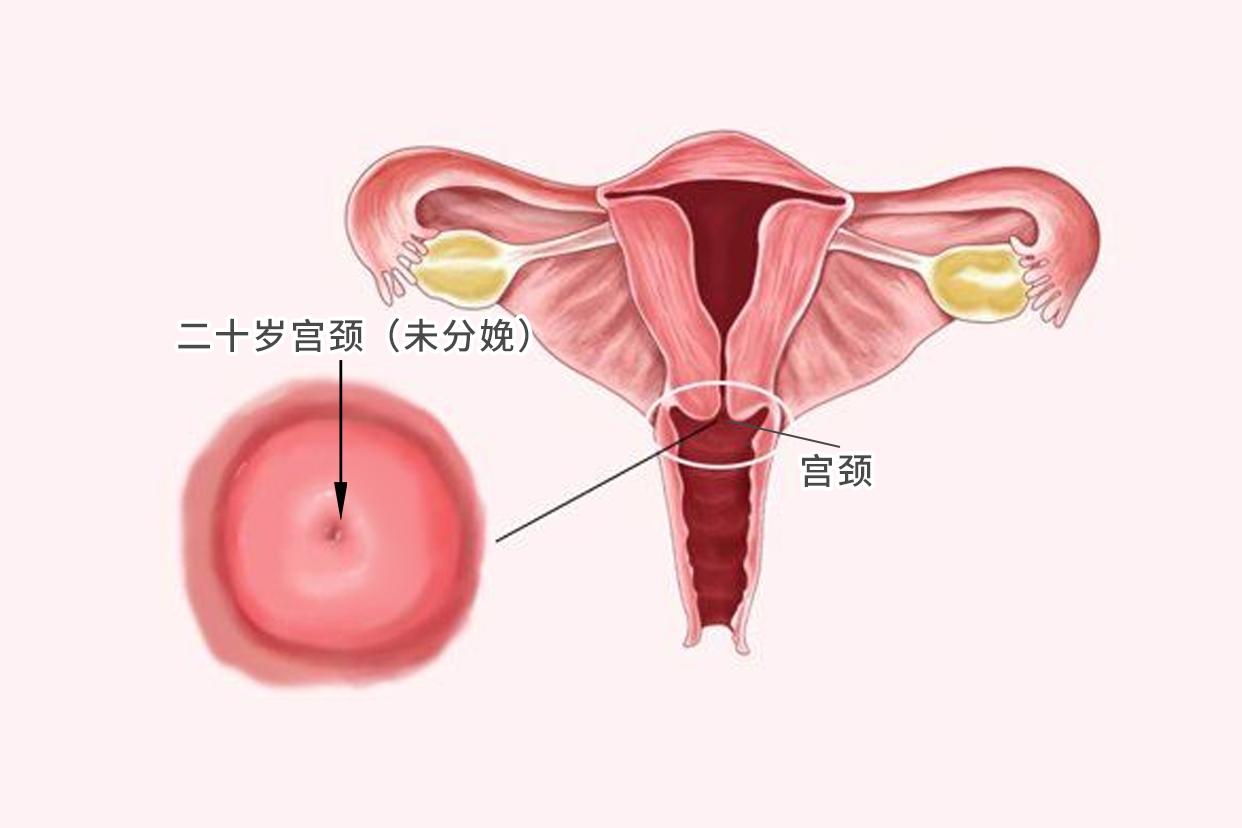 二十岁宫颈图片 二十多岁宫颈肥大是怎么回事啊