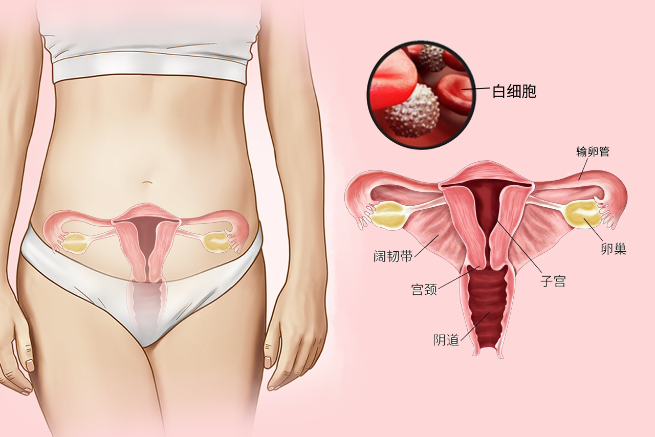 阴道镜检白细胞图片