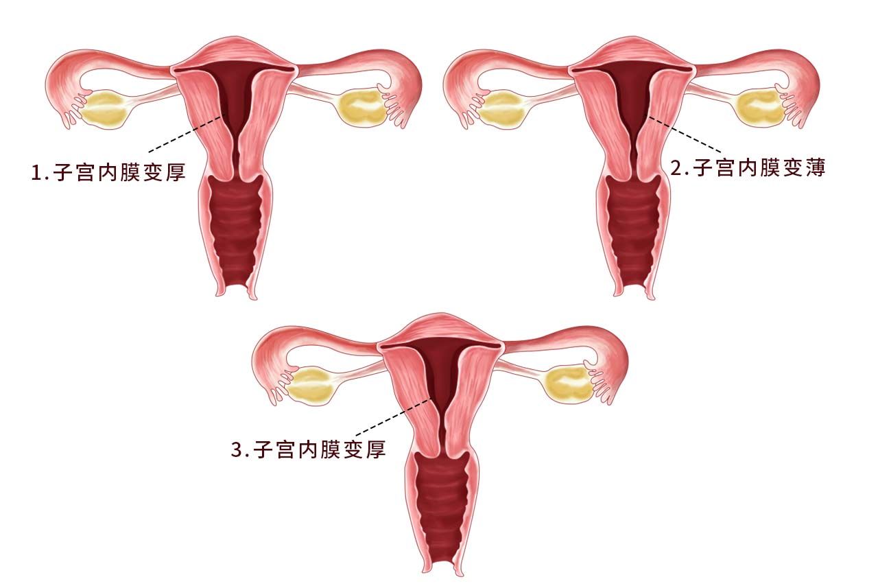 子宫一个月的变化图片 一个月的子宫有多大